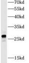 Glutathione S-Transferase Mu 1 antibody, FNab09966, FineTest, Western Blot image 