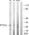 PTTG1 Regulator Of Sister Chromatid Separation, Securin antibody, TA312966, Origene, Western Blot image 