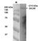 Dicer 1, Ribonuclease III antibody, MA5-27595, Invitrogen Antibodies, Western Blot image 