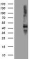 Serpin Family E Member 2 antibody, LS-C173876, Lifespan Biosciences, Western Blot image 