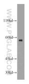 Solute Carrier Family 38 Member 4 antibody, 20857-1-AP, Proteintech Group, Western Blot image 