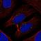 TXK Tyrosine Kinase antibody, HPA062482, Atlas Antibodies, Immunofluorescence image 