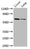 Liver carboxylesterase N antibody, A53543-100, Epigentek, Western Blot image 