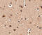 SLIT and NTRK-like protein 4 antibody, A14468, Boster Biological Technology, Immunohistochemistry paraffin image 