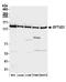 Elongation Factor Like GTPase 1 antibody, A305-854A-M, Bethyl Labs, Western Blot image 