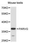 Parvin Gamma antibody, LS-C747947, Lifespan Biosciences, Western Blot image 