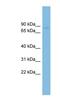 Family With Sequence Similarity 160 Member B2 antibody, NBP1-57748, Novus Biologicals, Western Blot image 