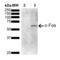 Ataxin 1 antibody, SMC-475D-A594, StressMarq, Western Blot image 