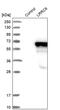 Leucine Rich Repeat Containing 6 antibody, PA5-55756, Invitrogen Antibodies, Western Blot image 