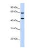 PC-Esterase Domain Containing 1A antibody, NBP1-55522, Novus Biologicals, Western Blot image 