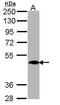 MAS Related GPR Family Member X4 antibody, PA5-21918, Invitrogen Antibodies, Western Blot image 