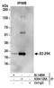 Ubiquitin Conjugating Enzyme E2 K antibody, A304-125A, Bethyl Labs, Immunoprecipitation image 
