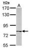 Bardet-Biedl Syndrome 7 antibody, TA308242, Origene, Western Blot image 