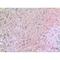 Vascular Endothelial Growth Factor C antibody, LS-C387076, Lifespan Biosciences, Immunohistochemistry paraffin image 