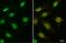 FA Complementation Group D2 antibody, GTX70299, GeneTex, Immunocytochemistry image 