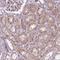 Rho Family GTPase 3 antibody, NBP2-49315, Novus Biologicals, Immunohistochemistry paraffin image 
