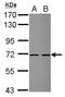 Zinc Finger SWIM-Type Containing 2 antibody, LS-C155566, Lifespan Biosciences, Western Blot image 