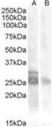 Myogenic factor 5 antibody, NB100-93518, Novus Biologicals, Western Blot image 