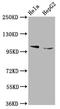 Elongator Complex Protein 1 antibody, CSB-PA011571LA01HU, Cusabio, Western Blot image 