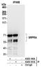 SRP Receptor Subunit Alpha antibody, A305-141A, Bethyl Labs, Immunoprecipitation image 