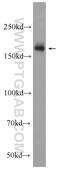 Regulating Synaptic Membrane Exocytosis 1 antibody, 24576-1-AP, Proteintech Group, Western Blot image 