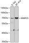Matrix Metallopeptidase 25 antibody, GTX54370, GeneTex, Western Blot image 
