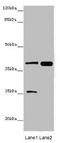 Mitogen-Activated Protein Kinase Kinase 3 antibody, A54584-100, Epigentek, Western Blot image 