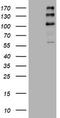 ALK Receptor Tyrosine Kinase antibody, TA801462, Origene, Western Blot image 
