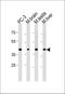 Cdk5 And Abl Enzyme Substrate 2 antibody, PA5-35257, Invitrogen Antibodies, Western Blot image 