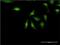 Use1 antibody, H00065264-M01, Novus Biologicals, Immunocytochemistry image 