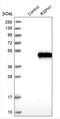 Radial Spoke Head Component 1 antibody, NBP1-89840, Novus Biologicals, Western Blot image 
