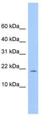MORN Repeat Containing 4 antibody, TA337580, Origene, Western Blot image 