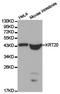 Keratin 20 antibody, TA326796, Origene, Western Blot image 