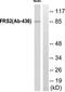 Lysophosphatidic Acid Receptor 5 antibody, TA315647, Origene, Western Blot image 