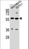 ATP Binding Cassette Subfamily G Member 4 antibody, LS-C155865, Lifespan Biosciences, Western Blot image 