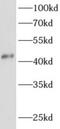 ArfGAP With Dual PH Domains 1 antibody, FNab00148, FineTest, Western Blot image 