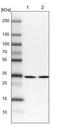 Sideroflexin 1 antibody, PA5-54019, Invitrogen Antibodies, Western Blot image 