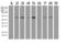 4-Aminobutyrate Aminotransferase antibody, LS-C796915, Lifespan Biosciences, Western Blot image 
