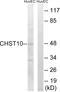 Carbohydrate Sulfotransferase 10 antibody, A30586, Boster Biological Technology, Western Blot image 