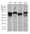 Granulin Precursor antibody, TA807357S, Origene, Western Blot image 