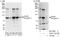 Insulin receptor beta antibody, A303-712A, Bethyl Labs, Western Blot image 