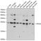 VPS28 Subunit Of ESCRT-I antibody, A06407, Boster Biological Technology, Western Blot image 