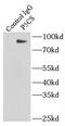 Aldehyde Dehydrogenase 18 Family Member A1 antibody, FNab06085, FineTest, Immunoprecipitation image 