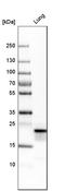 Pulmonary surfactant-associated protein C antibody, HPA010928, Atlas Antibodies, Western Blot image 