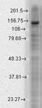 Potassium Sodium-Activated Channel Subfamily T Member 2 antibody, LS-C230816, Lifespan Biosciences, Western Blot image 