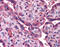 Acyl-CoA Synthetase Long Chain Family Member 1 antibody, ARP32784_P050, Aviva Systems Biology, Immunohistochemistry paraffin image 