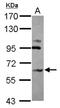 Carbohydrate sulfotransferase 15 antibody, NBP2-15896, Novus Biologicals, Western Blot image 