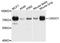 Leucine Rich Repeat And Ig Domain Containing 1 antibody, A9369, ABclonal Technology, Western Blot image 