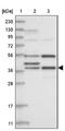 Zinc Finger CW-Type And PWWP Domain Containing 2 antibody, NBP1-80606, Novus Biologicals, Western Blot image 