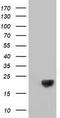 Destrin, Actin Depolymerizing Factor antibody, CF502622, Origene, Western Blot image 